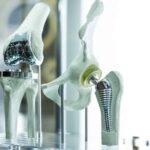 melhor-que-antibiotico?-metal-liquido-ajuda-a-combater-infeccoes-de-implantes-ortopedicos