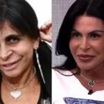 blefaroplastia:-quando-investir-no-procedimento-realizado-por-gretchen