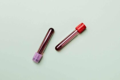 cientistas-recriam-sangue-humano-em-laboratorio