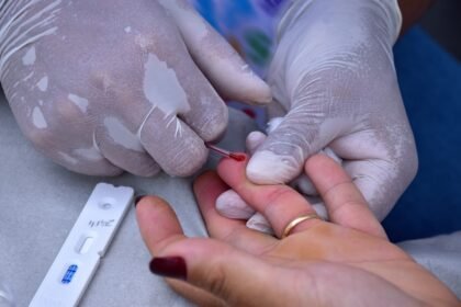 casos-de-sifilis-avancam-no-brasil.-veja-tira-duvidas-sobre-a-doenca
