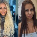 influencer-revela-que-refez-harmonizacao-facial-apos-dica-do-chatgpt