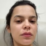 ex-bbb-e-internada-apos-sofrer-inflamacao-provocada-por-contraceptivo