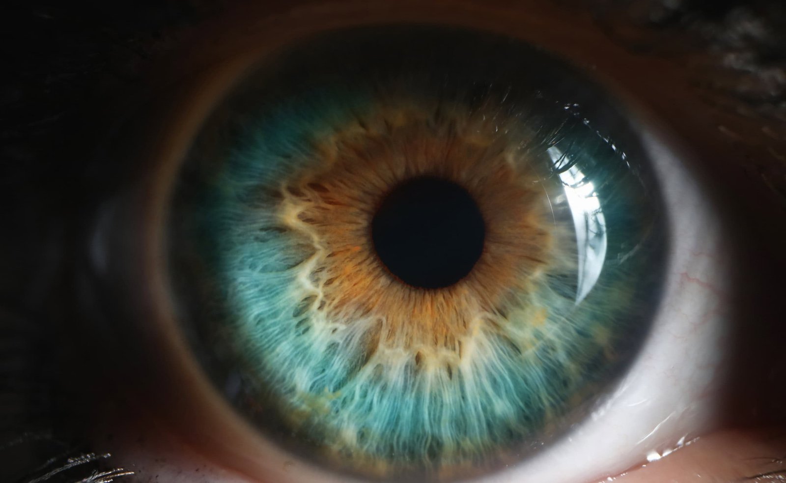 chip-nos-olhos-devolve-visao-apos-perda-parcial
