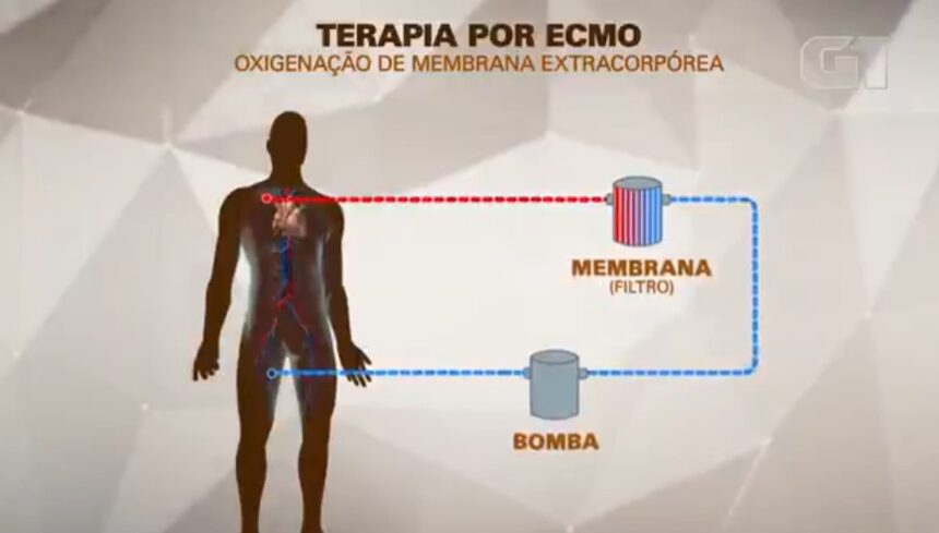 mc-marcinho-usa-terapia-conhecida-como-ecmo,-especie-de-pulmao-artificial;-entenda-como-funciona-|-g1