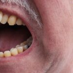 o-potencial-dos-canabinoides-nos-tratamentos-de-dor-|-g1