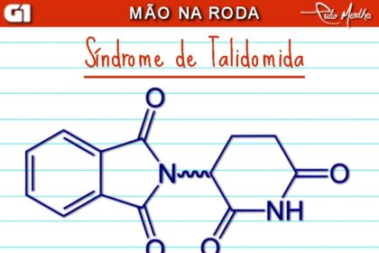 sindrome-de-talidomida:-saiba-o-que-e,-os-direitos-e-o-que-dispoe,-altera-e-sugere-a-lei-|-blog-mao-na-roda-da-rede-globo